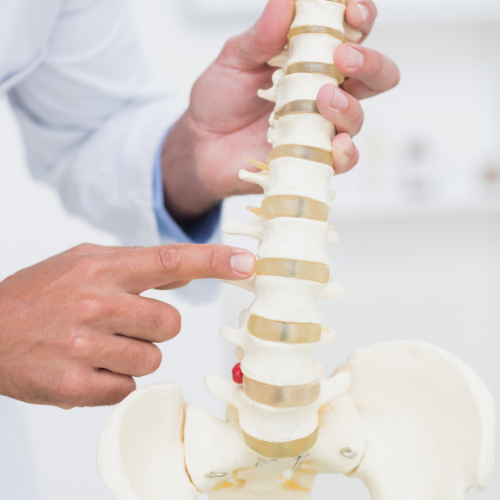 Spondilolistezis (Omurga Kayması)