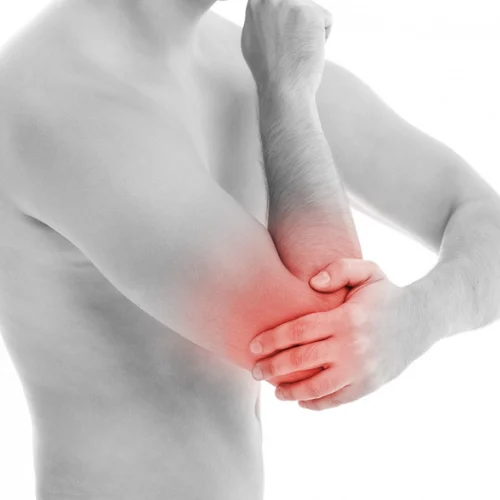 Cubital Tunnel Syndrome